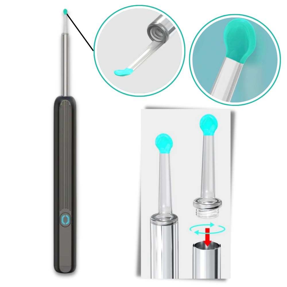 Câmera de limpeza de ouvido Foxnovo para remoção de cera, dispositivo de cuidado auricular com câmera para visualização detalhada