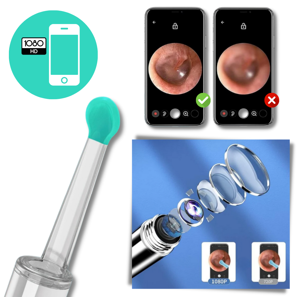 Câmera de limpeza de ouvido Foxnovo para remover cera, dispositivo de cuidado auditivo com câmera para inspeção visual.