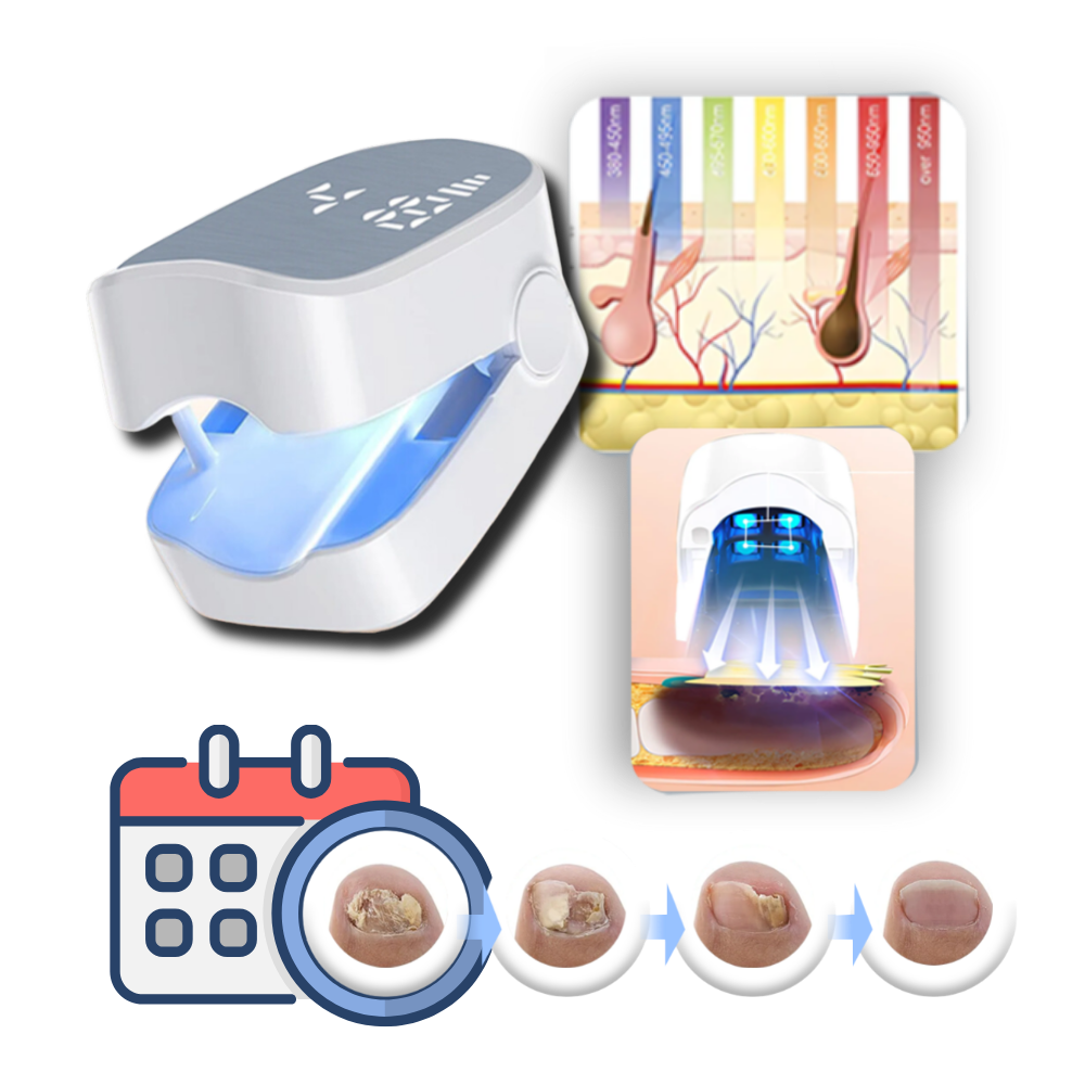Laser indolor para tratamento de micoses nas unhas, produto cosmético da marca Gh, imagem de equipamento de laser.