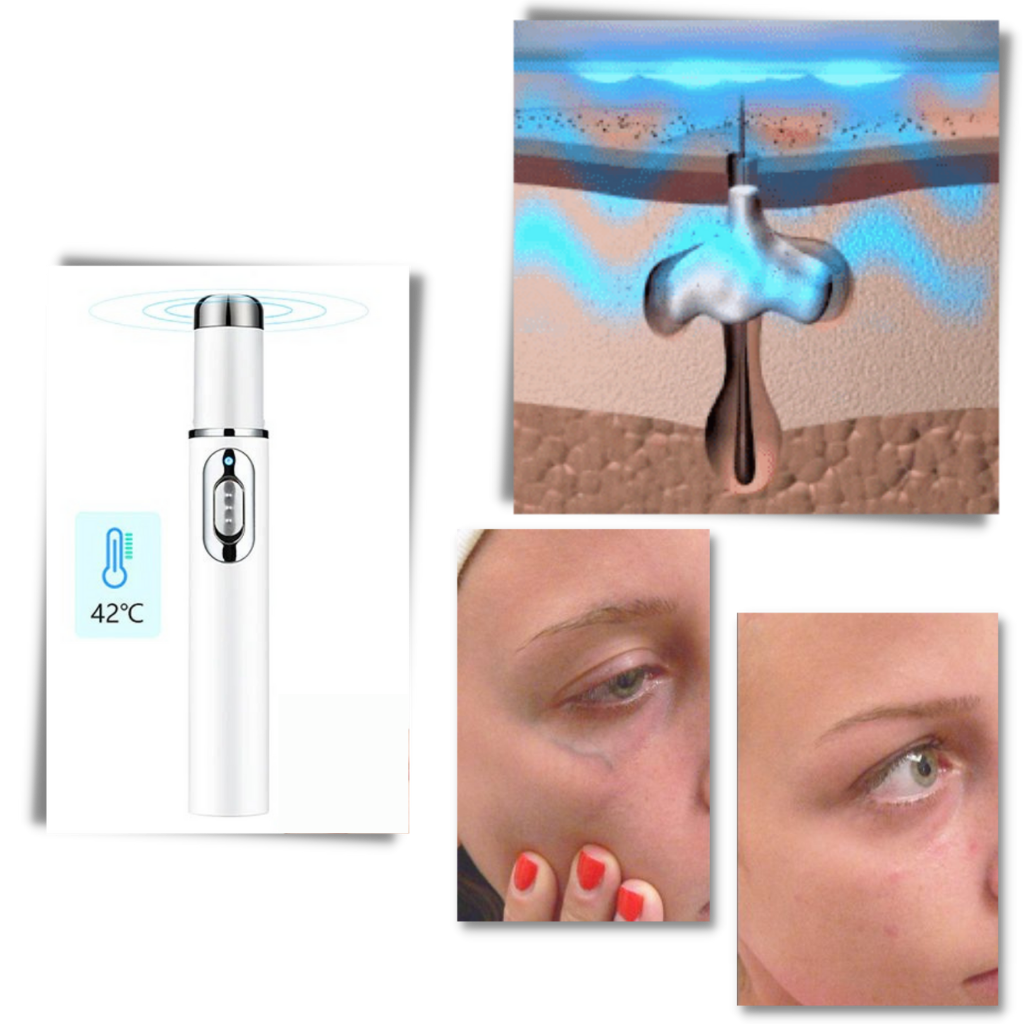 Stylo de terapia de pele com luz azul da marca Health&Beauty-Manufacturer, usado em luminoterapia para cuidados faciais.