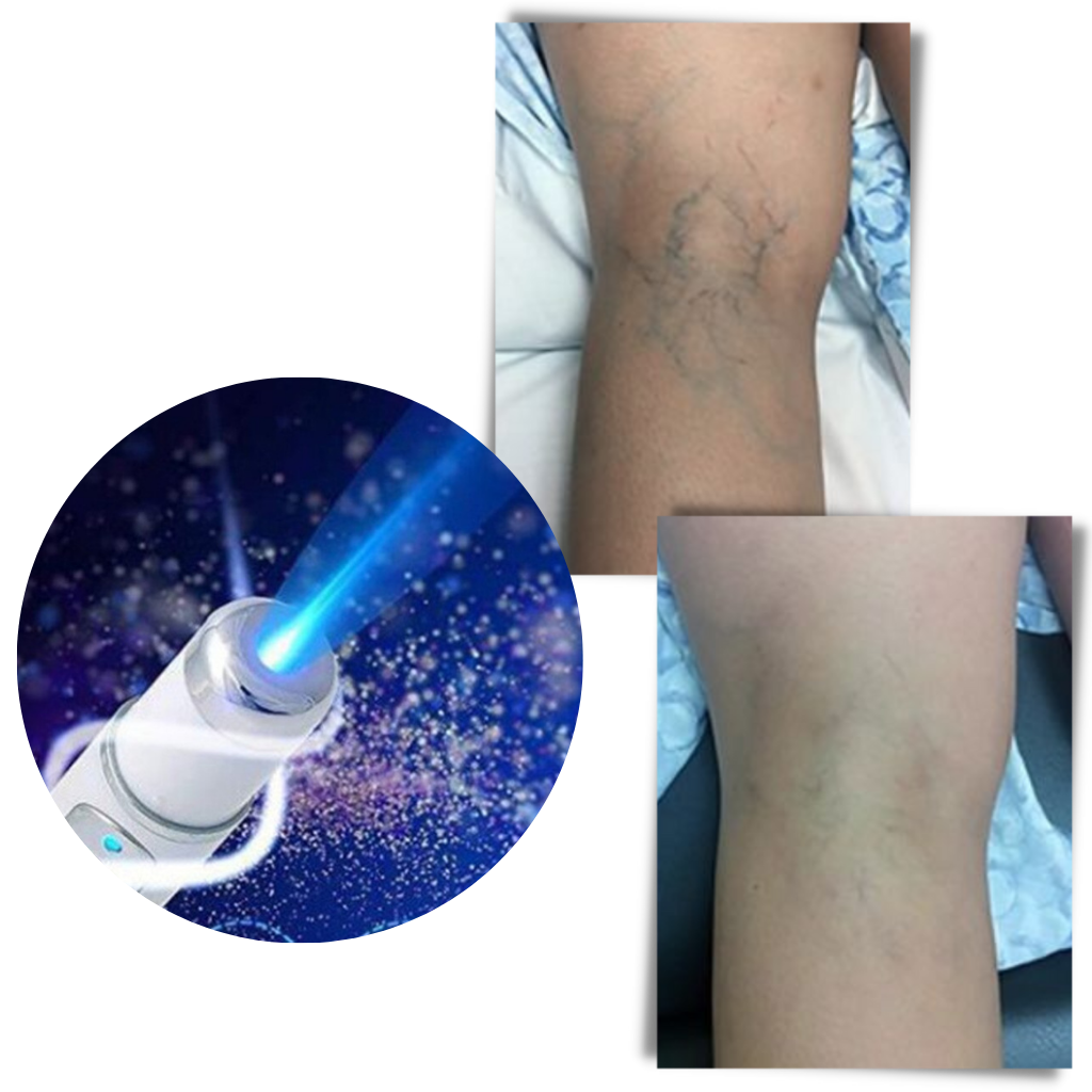 Lâmpada de luminoterapia Health&Beauty-Manufacturer para terapia de luz azul, usado para cuidados de pele e bem-estar.