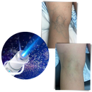 Lâmpada de luminoterapia Health&Beauty-Manufacturer para terapia de luz azul, usado para cuidados de pele e bem-estar.