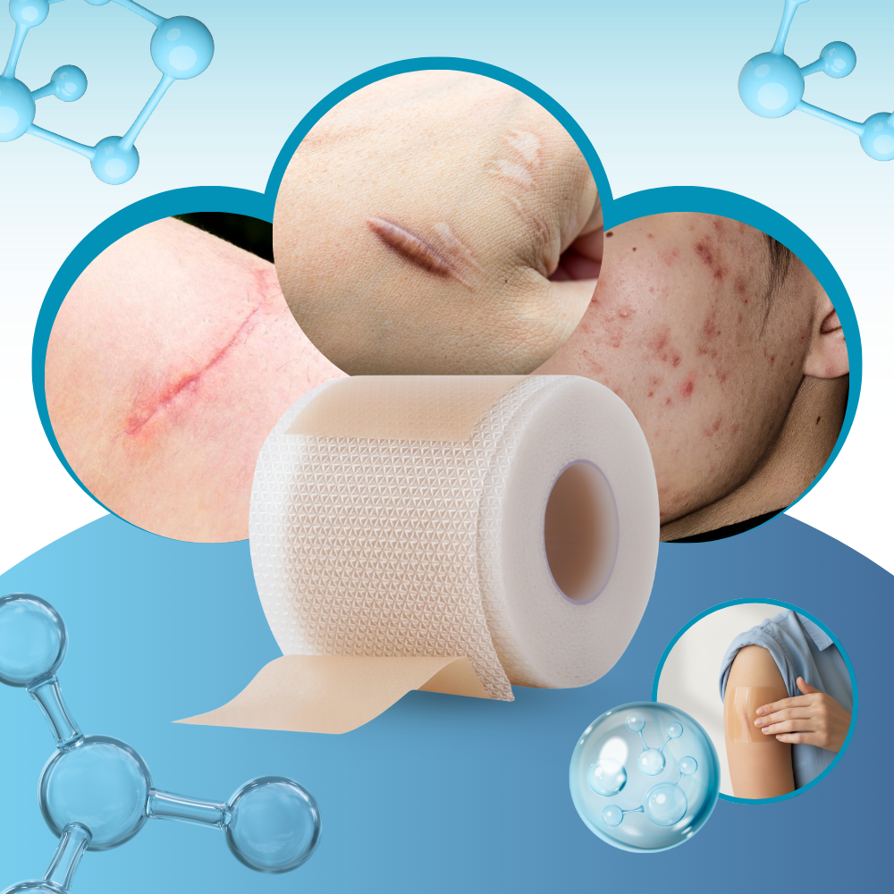 Adesivo de silicone com ácido hialurônico para cicatrizes, produto de primeiros socorros da marca Dongzhur, invisível na pele.