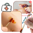 Cotons-tiges à l'iode et à l'alcool