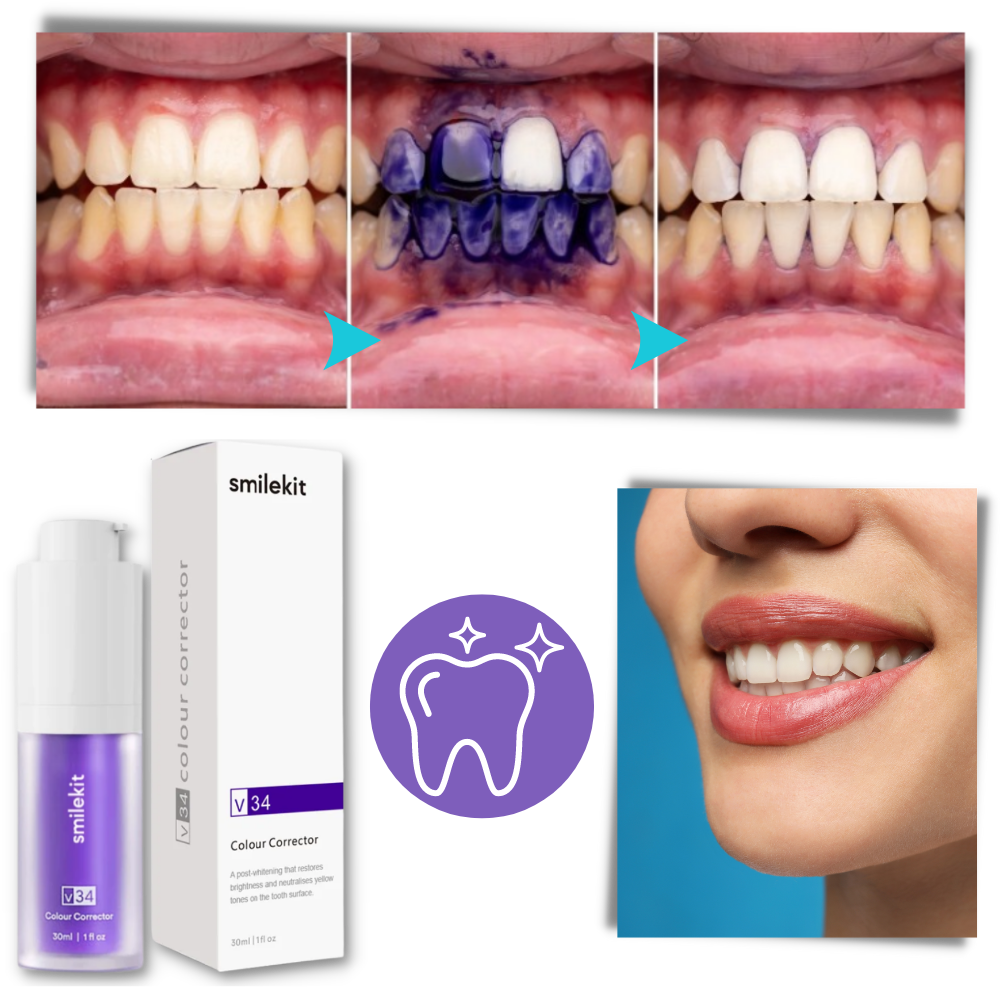 Dentifício violet éclaircissant Kesler para cuidados bucais, creme dental com efeito clareador e proteção para os dentes.
