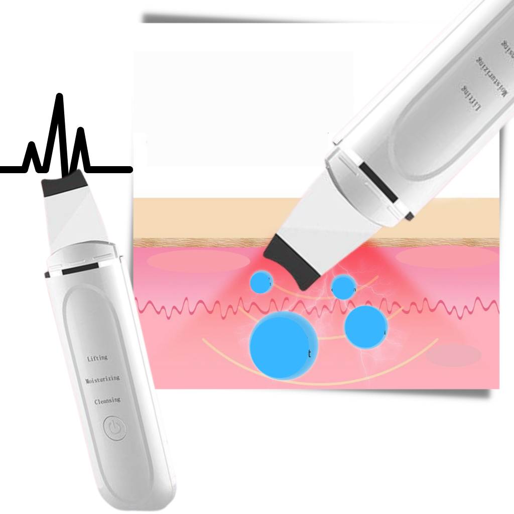 Spatula exfoliante ultrassônica para o rosto da marca Kinsei Beauty, usada em tratamentos de cuidados faciais.