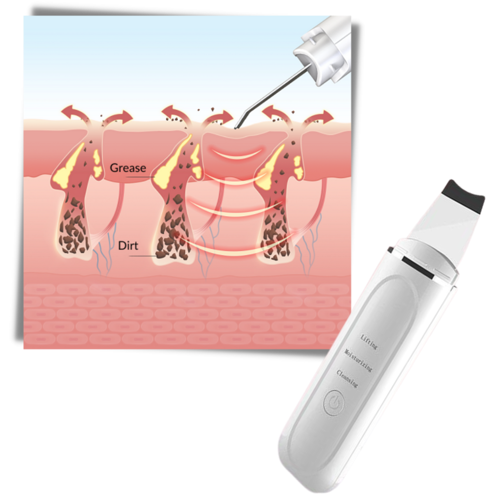 Espátula exfoliante ultrassônica para o rosto da marca Kinsei Beauty, usada para limpeza e cuidados faciais.