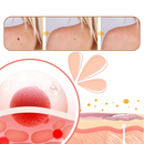 Tratamento não invasivo de excrescências com cosméticos Lin Chow, produto de cuidados para a pele natural e eficaz.