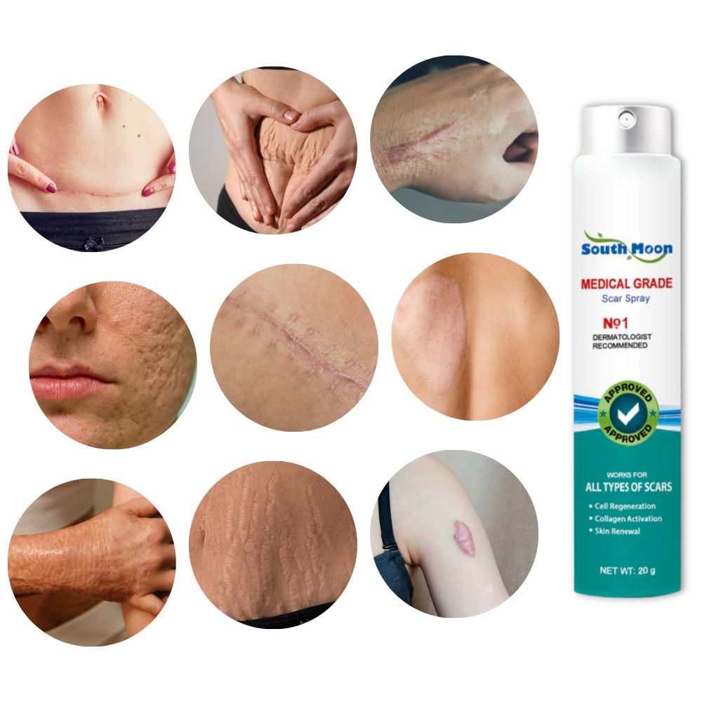 Spray terapêutico da Lnkhfs para eliminação de cicatrizes, embalagem com frasco de spray para cuidados cosméticos da pele.