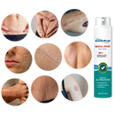 Spray terapêutico da Lnkhfs para eliminação de cicatrizes, embalagem com frasco de spray para cuidados cosméticos da pele.
