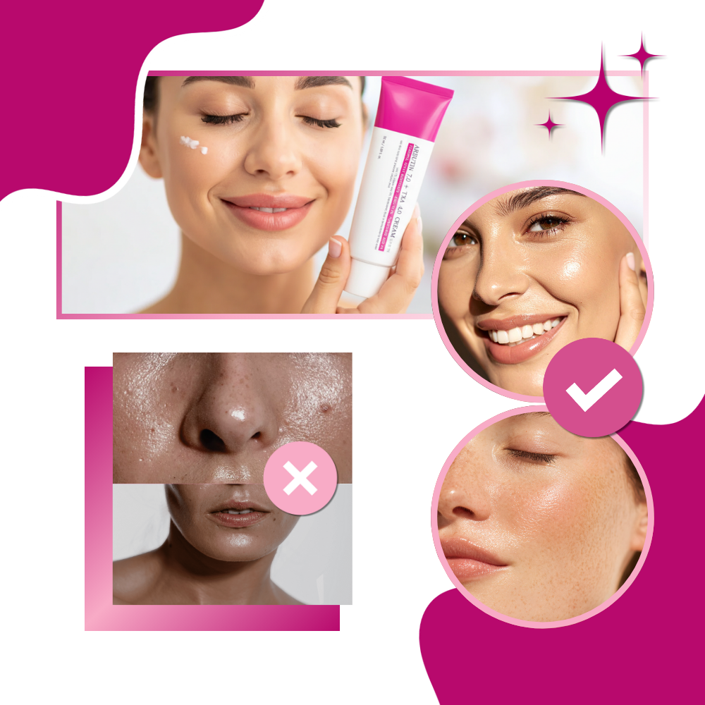 Creme da Mantong com arbutina e ácido tranexâmico, cosmético para cuidados faciais com textura cremosa e embalagem branca