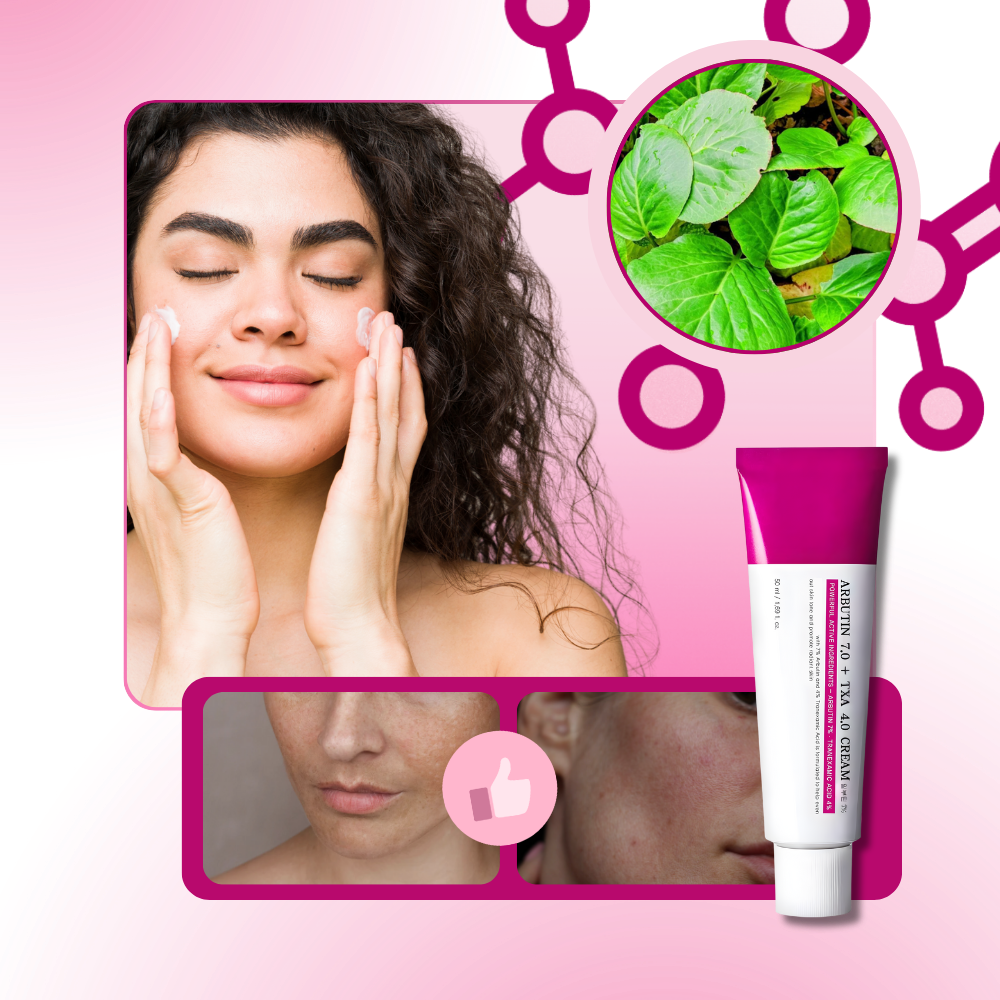 Creme cosmético Mantong com arbutina e ácido tranexâmico para cuidados de pele, embalagem com tubo branco e roxo.