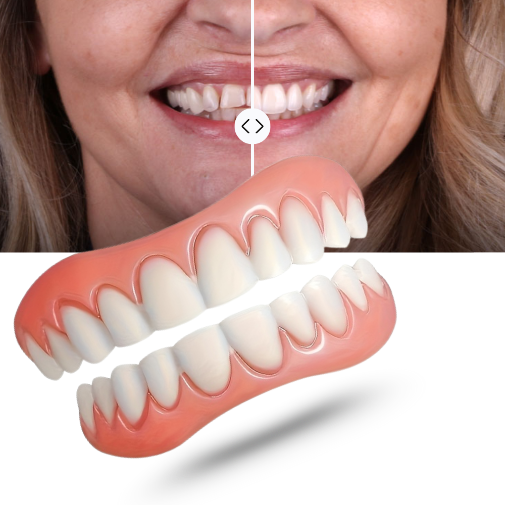 Kit de próteses dentárias Mlfire, incluindo ferramentas e produtos de cuidados bucais para próteses dentárias.