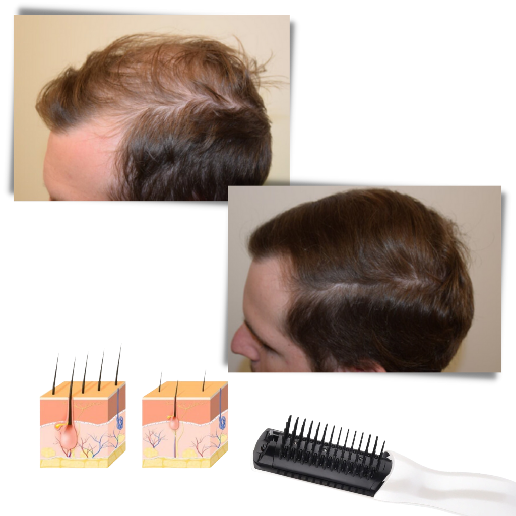 Peigne à laser infravermelho Ms.Dear para cuidado dos cabelos, com cabos e tecnologia de terapia capilar.
