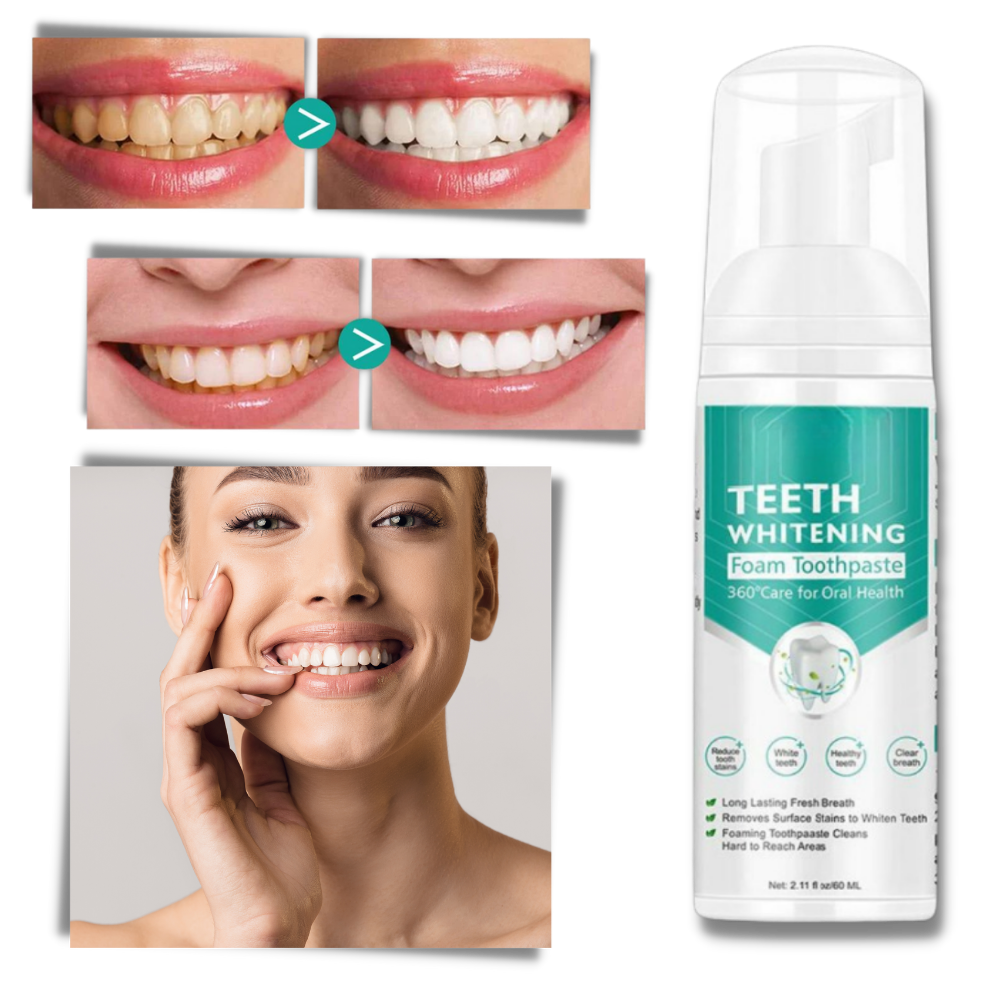Mousse branqueadora para dentes da marca Ounabing, produto de cuidados bucais com embalagem branca e aplicação fácil