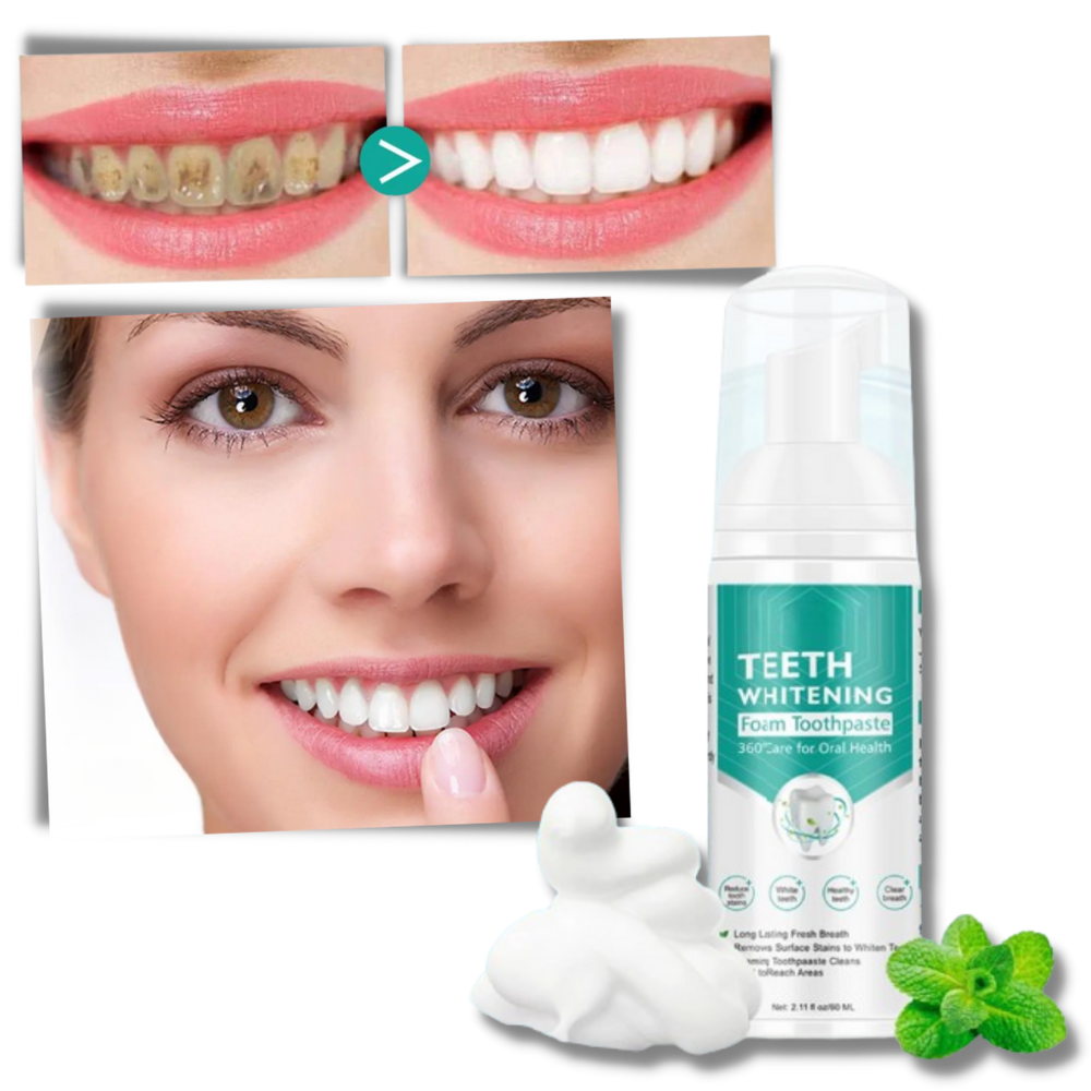 Mousse branqueadora para dentes da marca Ounabing, produto de cuidados bucais com embalagem branca e detalhes em azul