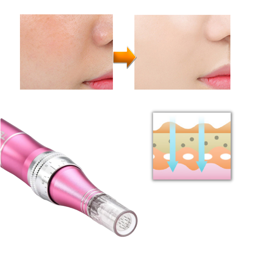 Stylo Dermique de Micro-aiguilletage da Pakainn, cosmético para cuidados faciais com agulhas finas e design rosa.