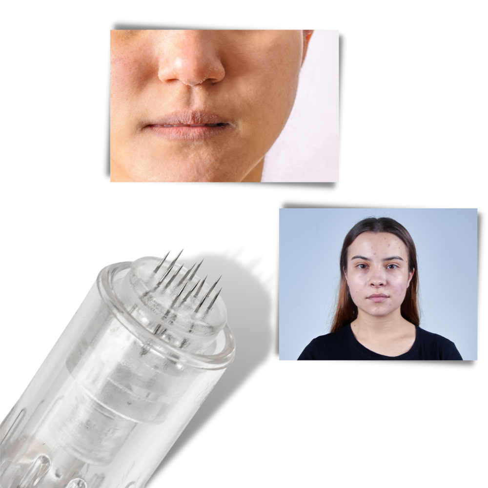 Stylo Dermique de Micro-aiguilletage da Pakainn, dispositivo cosmético Rose para tratamentos de pele.