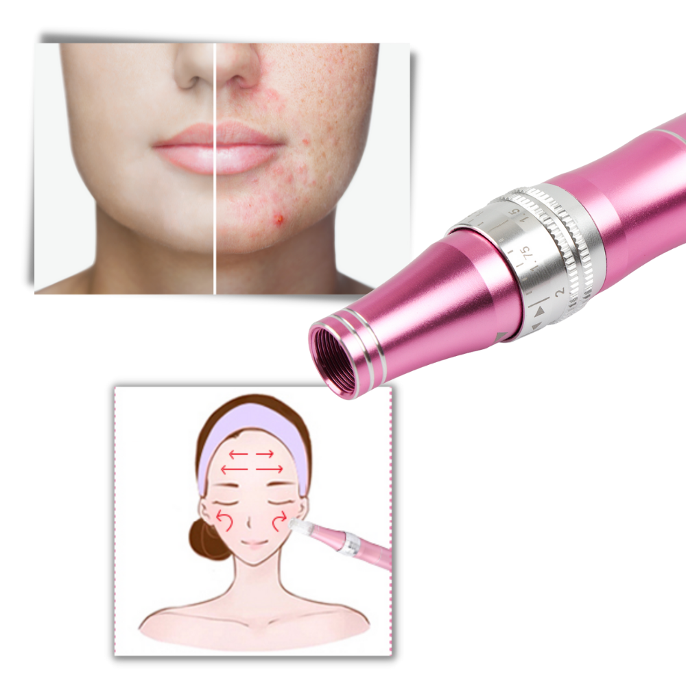 Stylo Dermique de Micro-aiguilletage da Pakainn, ferramenta de cosméticos com ponta fina para tratamentos de pele.