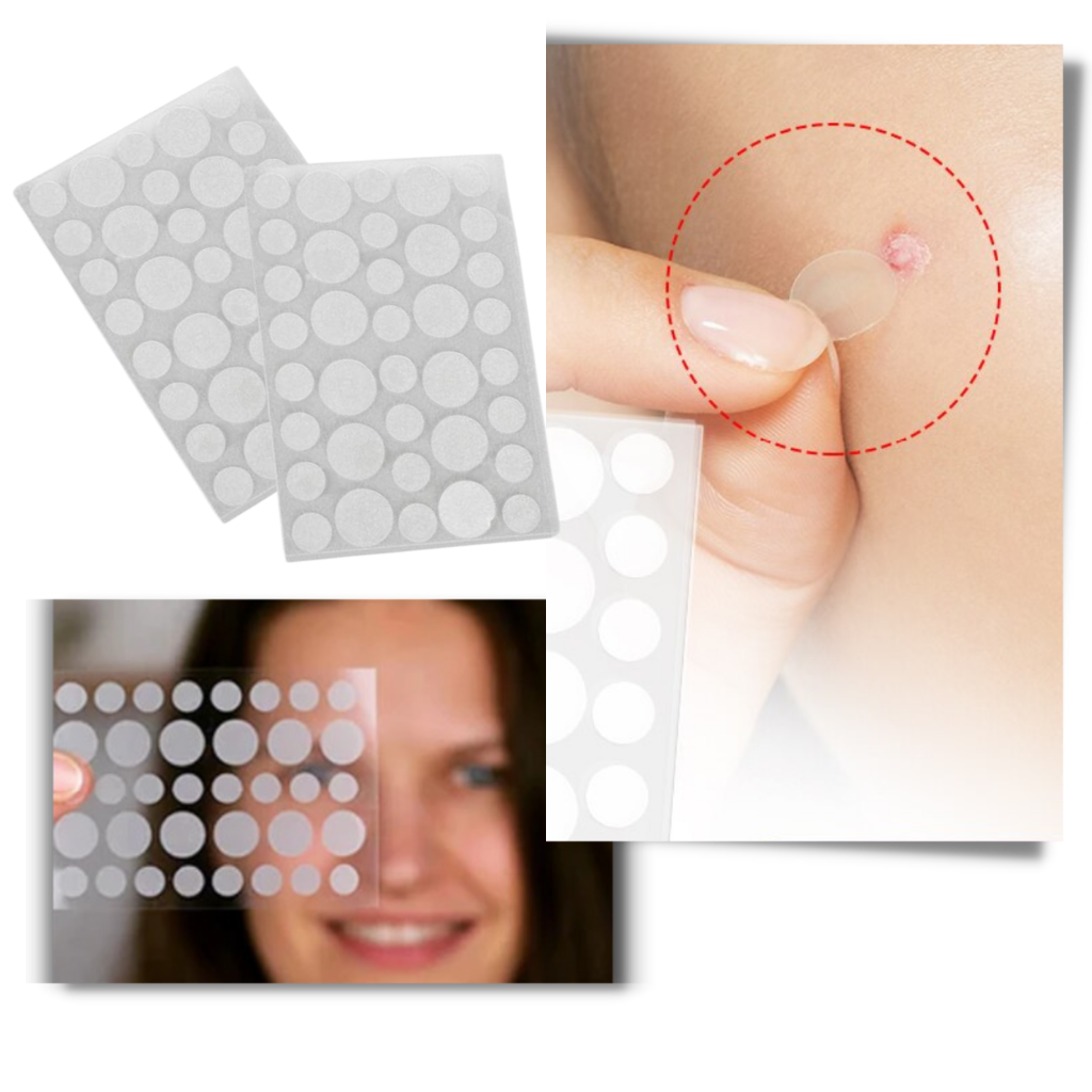 Pack com 36 patches invisíveis contra acne, produtos de cuidados pessoais da marca Personal Care Kit para mulheres.
