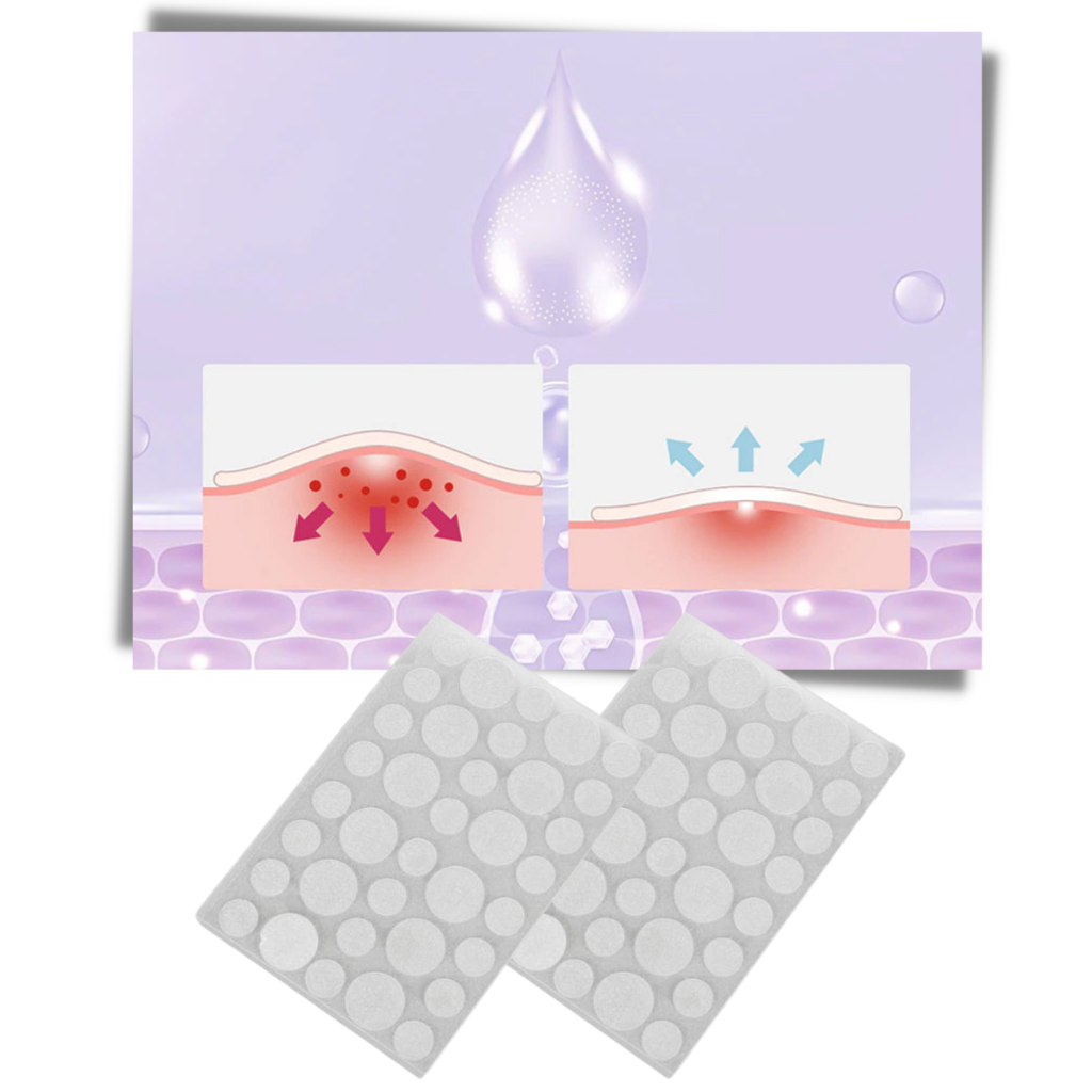 Pack de 36 patches invisíveis contra acne da marca Personal Care Kit For Women, pequenos e transparentes na pele.