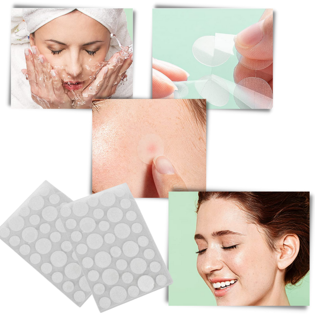 Conjunto de 36 patches invisíveis para acne, cosméticos da marca Personal Care Kit for Women, para tratamento de acne.