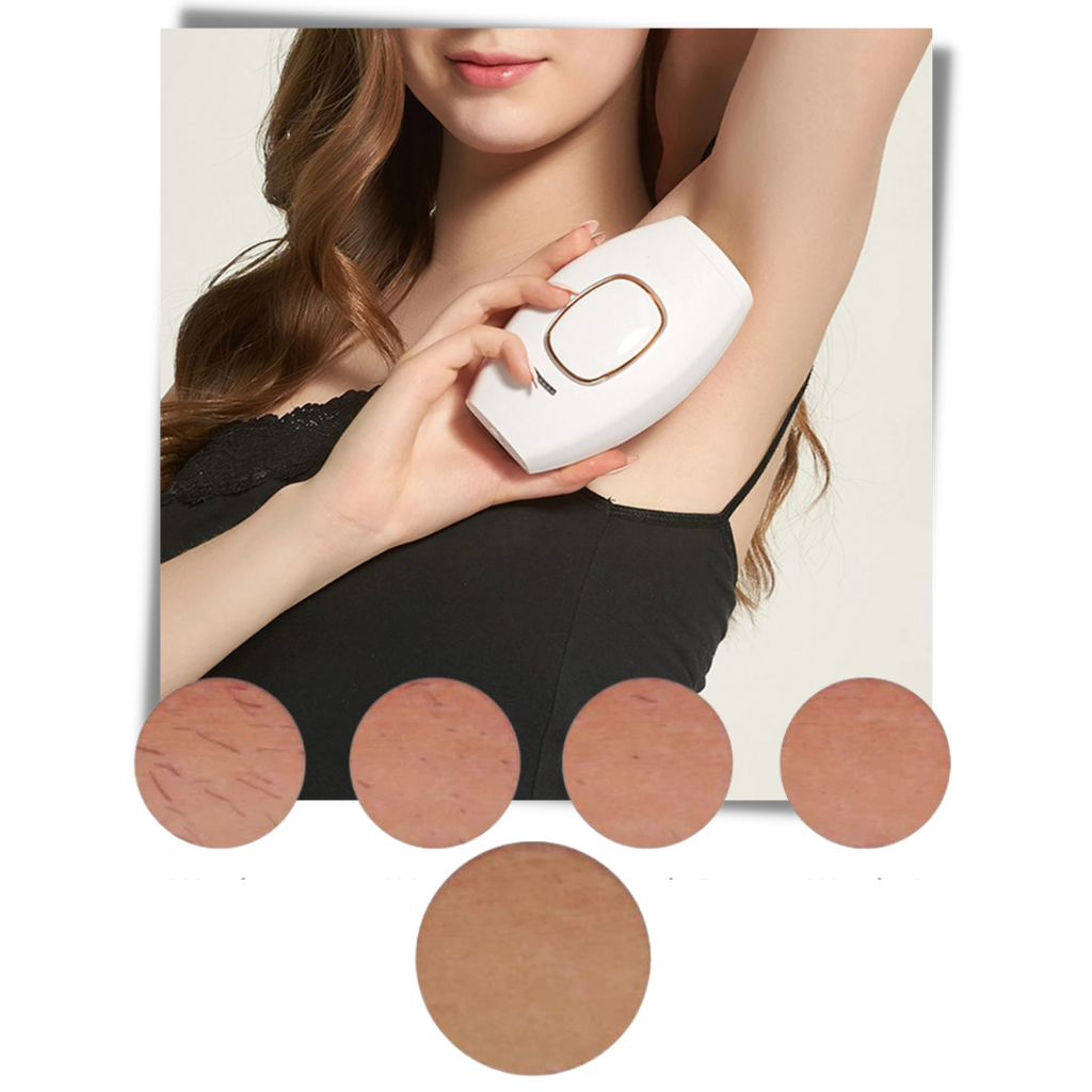Mini épilateur laser IPL da Project Retro para rasage e cuidados, dispositivo compacto e eficiente para remoção de pelos.