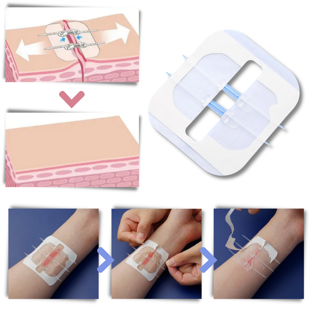 Curativo adesivo impermeável para feridas, marca Cairoyar, usado em primeiros socorros para proteção e cicatrização rápida.