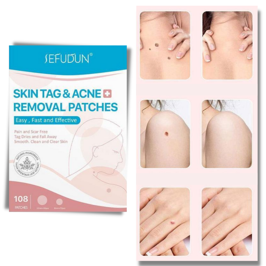 Patch de tratamento anti excrescências cutâneas Rinhoo, produto cosmético para remoção de verrugas e lesões na pele.