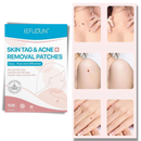 Patch de tratamento anti excrescências cutâneas Rinhoo, produto cosmético para remoção de verrugas e lesões na pele.