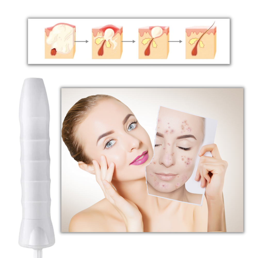 Luminoterapia anti-idade da Rosemary, dispositivo de cosméticos para revitalizar a pele com luz LED.