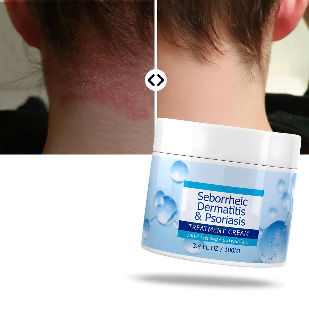Creme hidratante para o couro cabeludo da marca Shuhao Ruan, fórmula suave para cuidados capilares e hidratação.