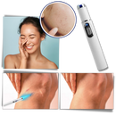 Caneta laser azul para eliminação de manchas, produto cosmético da marca Smallbee, com apontador e detalhes visíveis.