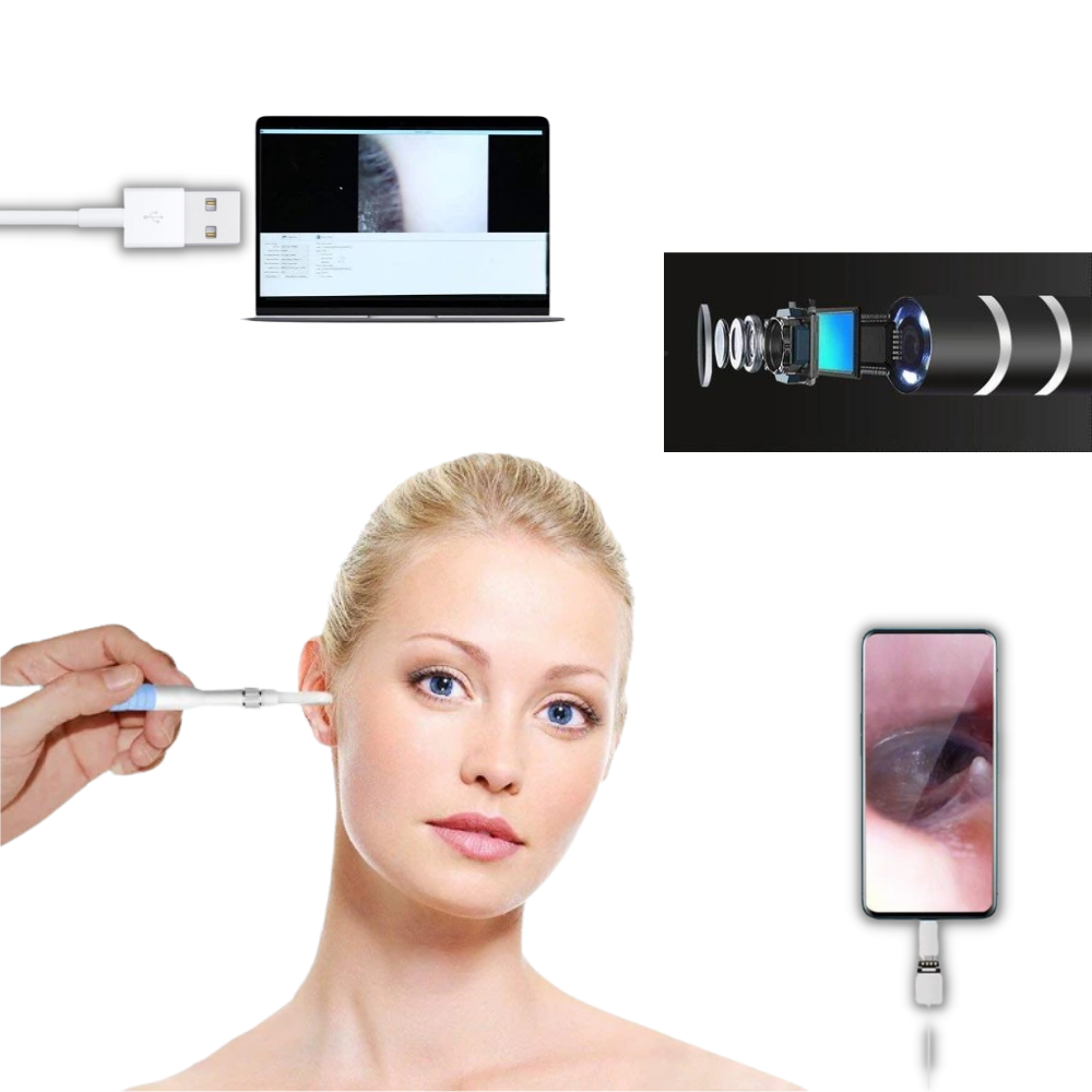 Câmera auricular 3 em 1 Spencer para cuidado dos ouvidos, em cor preta, com design compacto e funcional.