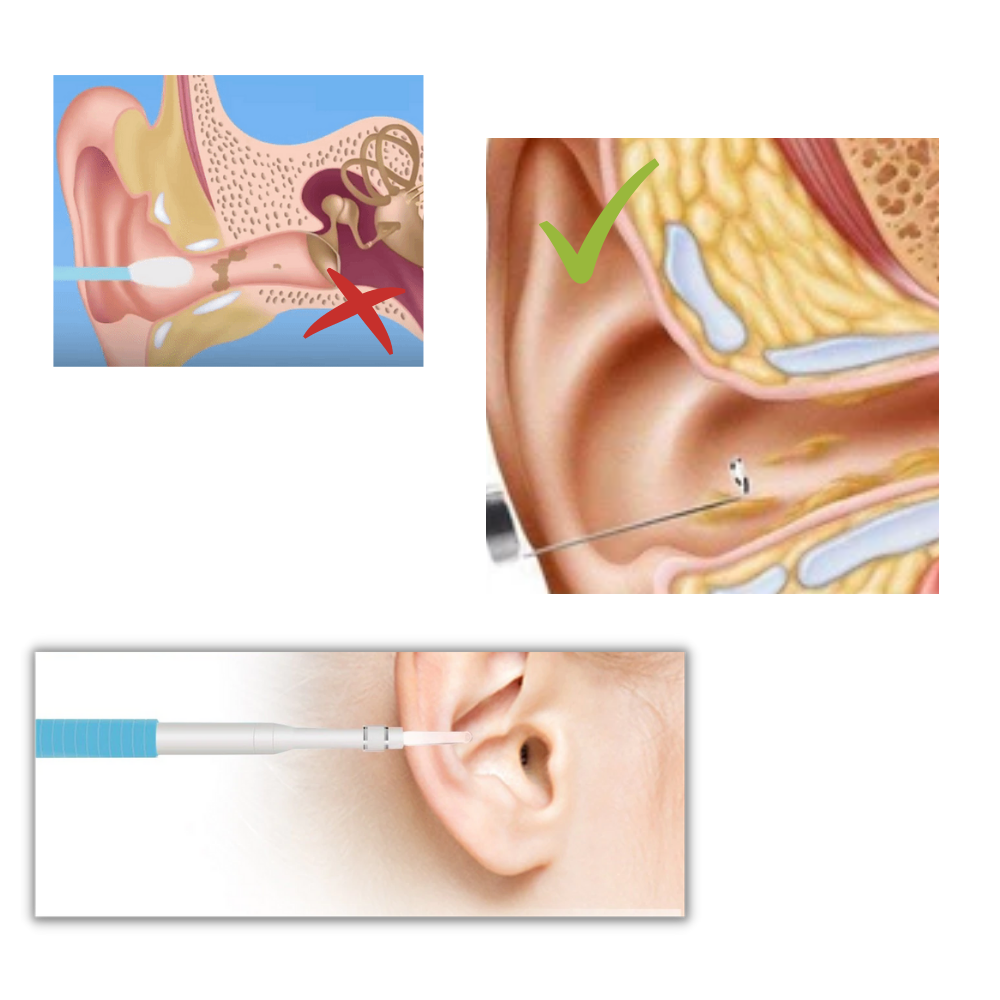 Câmera auricular 3 em 1 da Spencer para cuidados de ouvido, com design preto e funcionalidade múltipla.