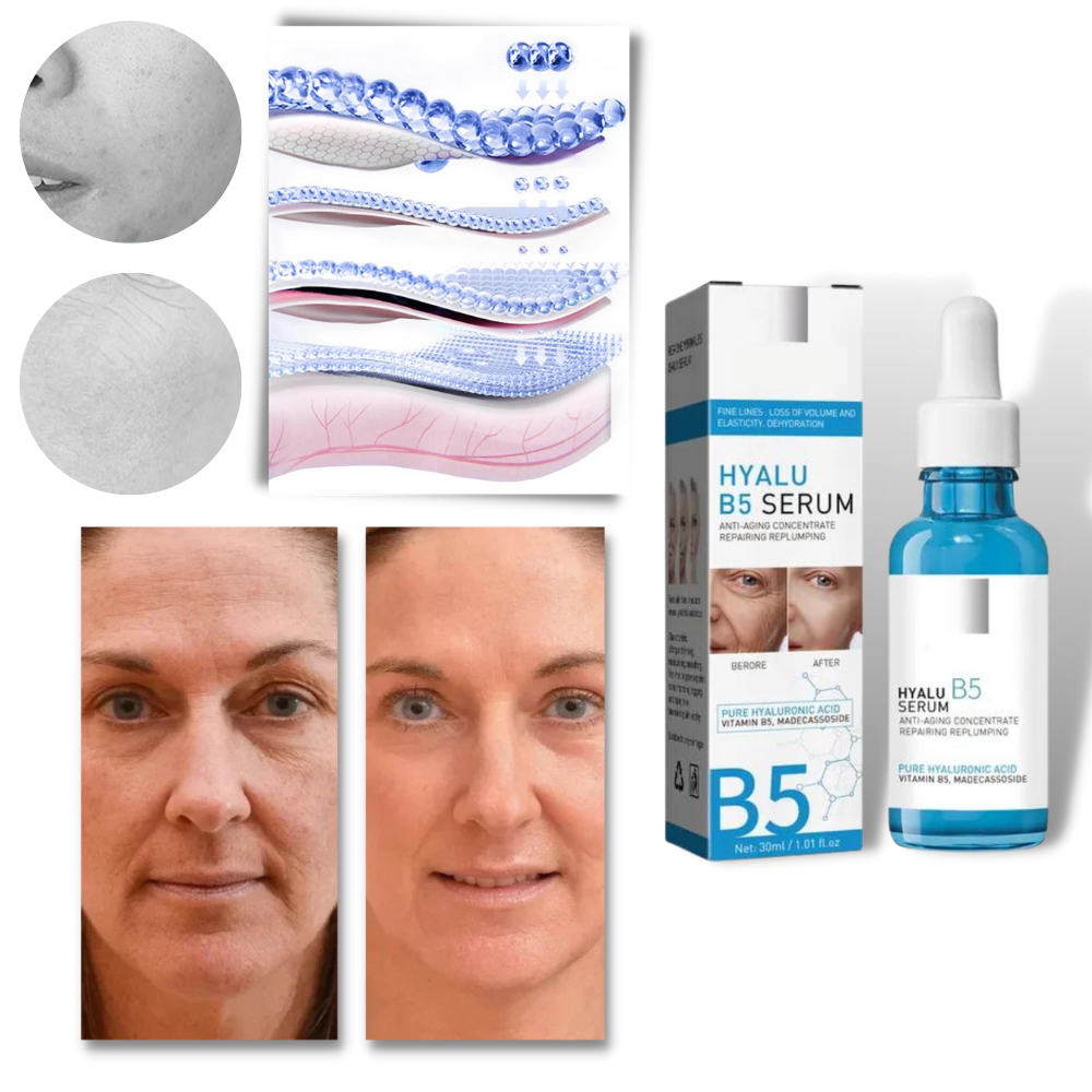 Sérum rajeunissant à l'acide hyaluronique Hyalu B5 da marca Tabbyc, frasco com sérum para revitalizar a pele.