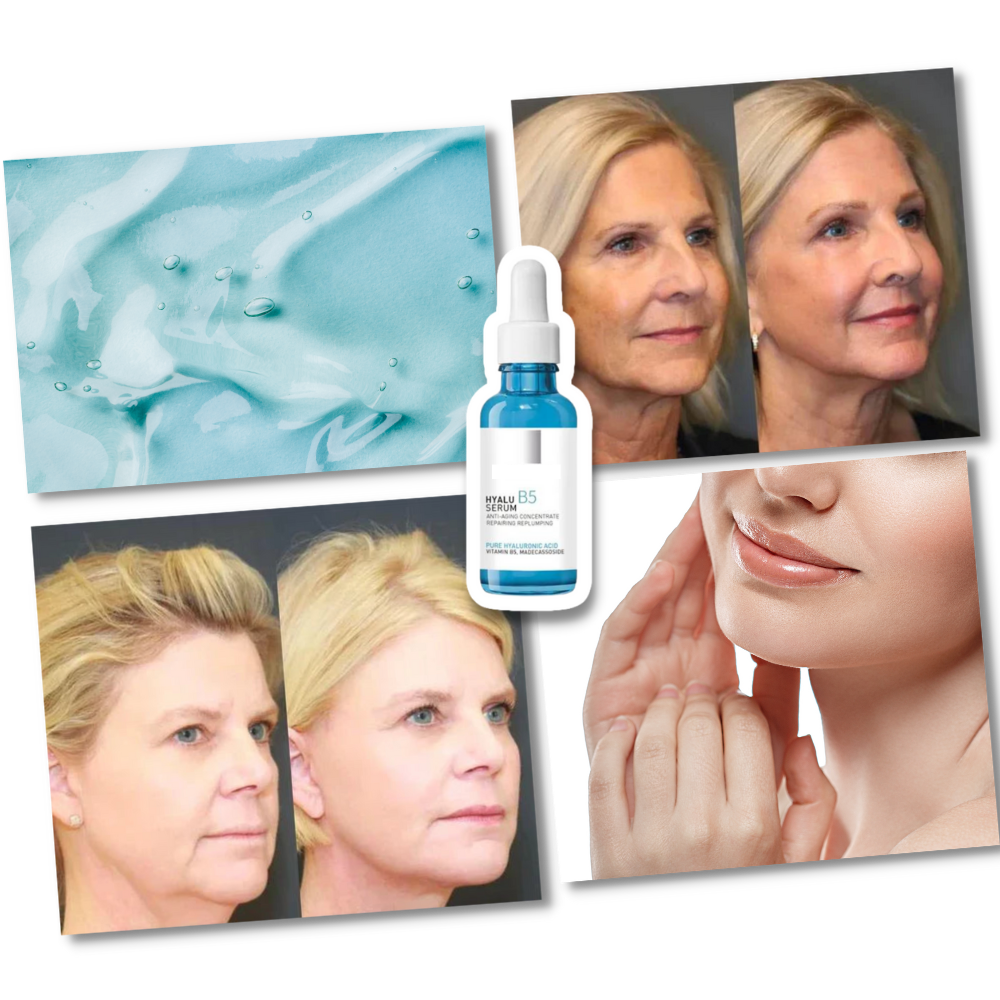 Sérum rajeunissant à l'acide hyaluronique Hyalu B5 da Tabbyc, cosmético para hidratação e rejuvenescimento da pele.