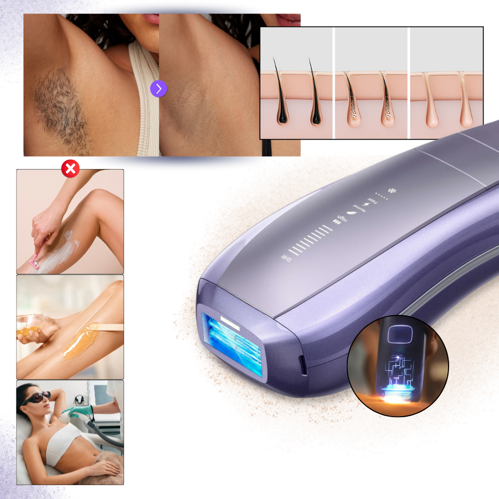 Dispositivo de depilação a laser Ulike para cuidados e remoção de pelos, com design moderno e visor digital.