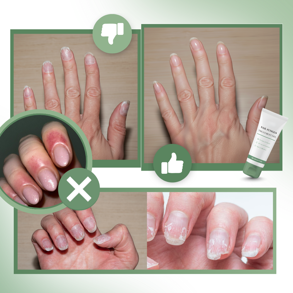 Gel fortalecedor e hidratante para unhas da marca Vakind, com textura transparente e aplicação suave.