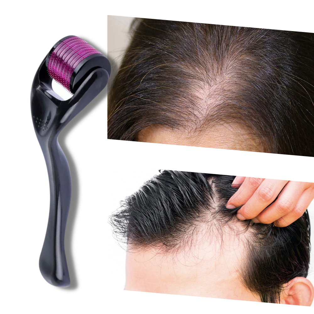 Rouleau dermique preto para crescimento de cabelo e barba, produto de cuidado capilar da marca Valy Layton.