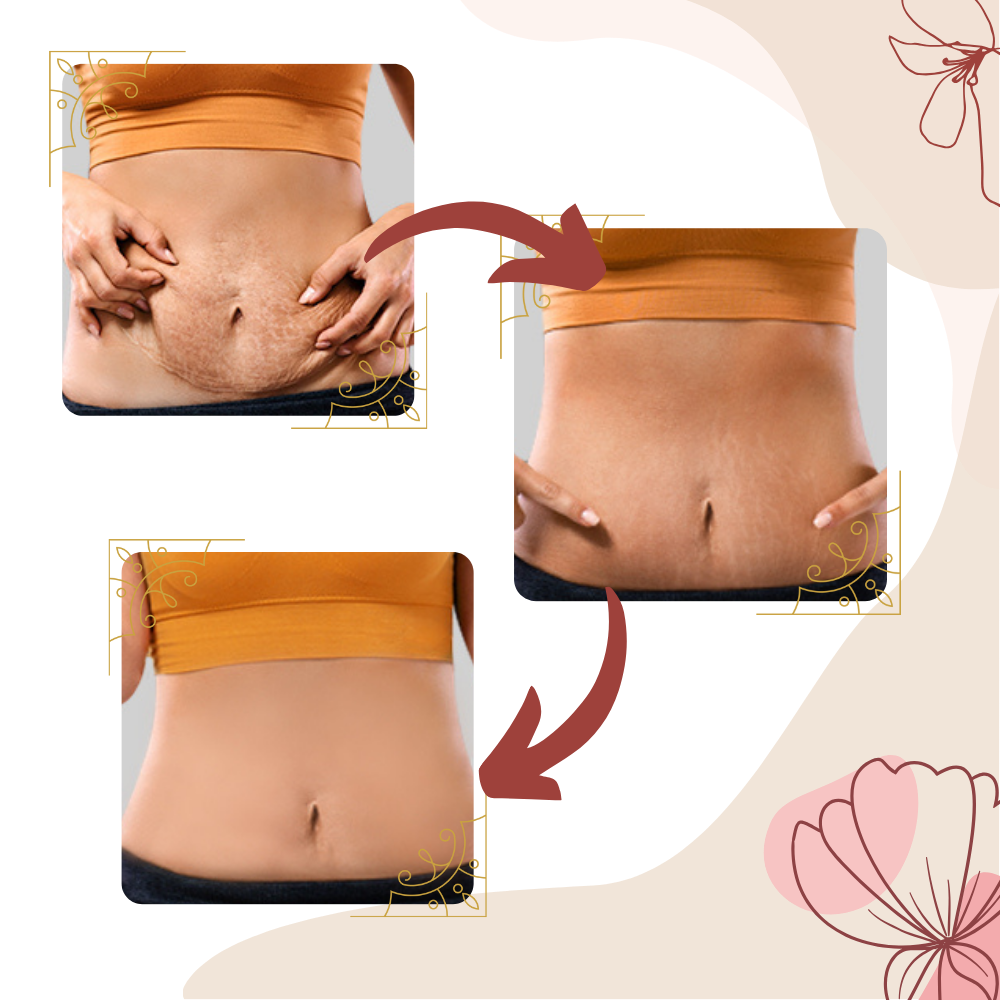 Massajador anti-cellulite Vanipuff com vibrações de alta frequência para massagem e relaxamento corporal.