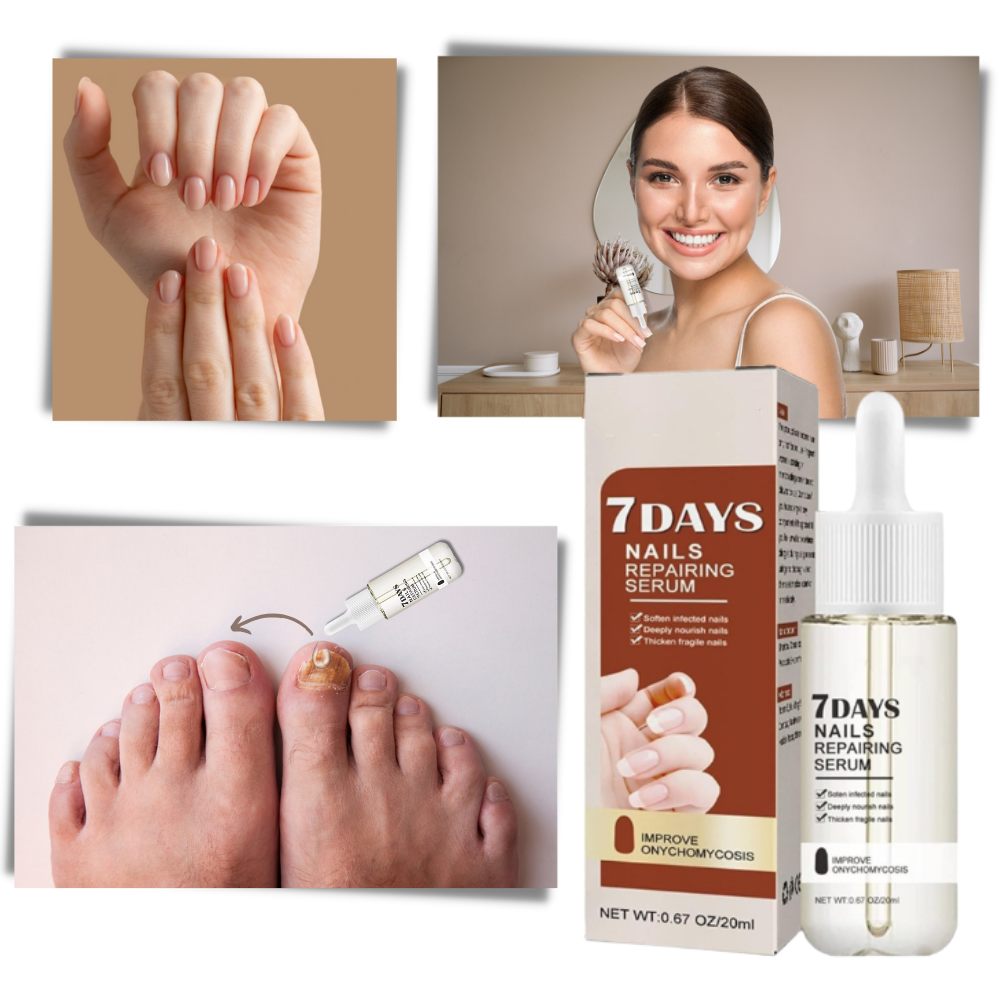 Sérum reparador para unhas Yohome, frasco com conta-gotas, indicado para fortalecer e recuperar unhas frágeis em 7 dias
