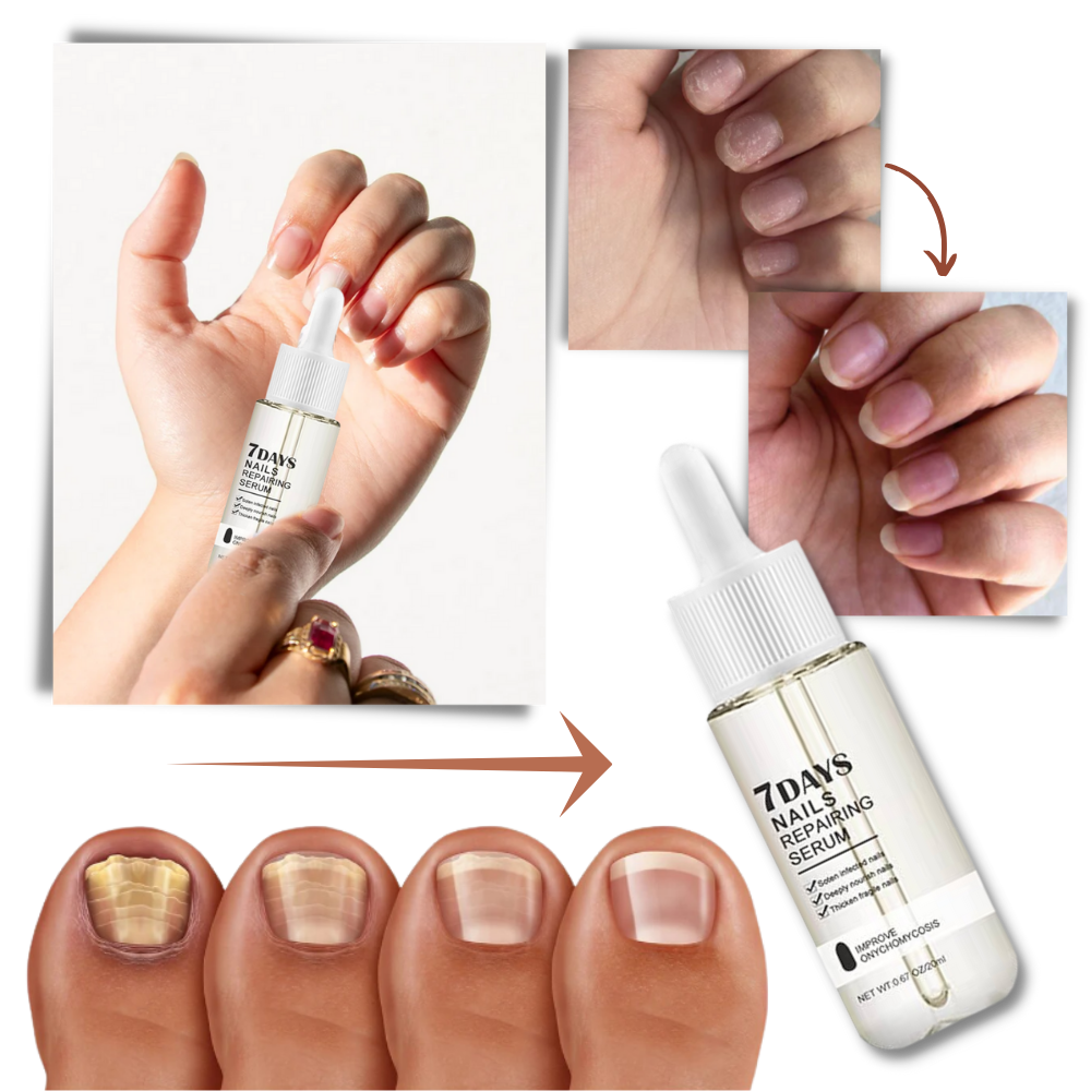 Sérum reparador para unhas Yohome, cosmético, aplicado nas unhas, ajuda na reparação em 7 dias.