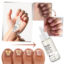 Sérum reparador para unhas Yohome, cosmético, aplicado nas unhas, ajuda na reparação em 7 dias.