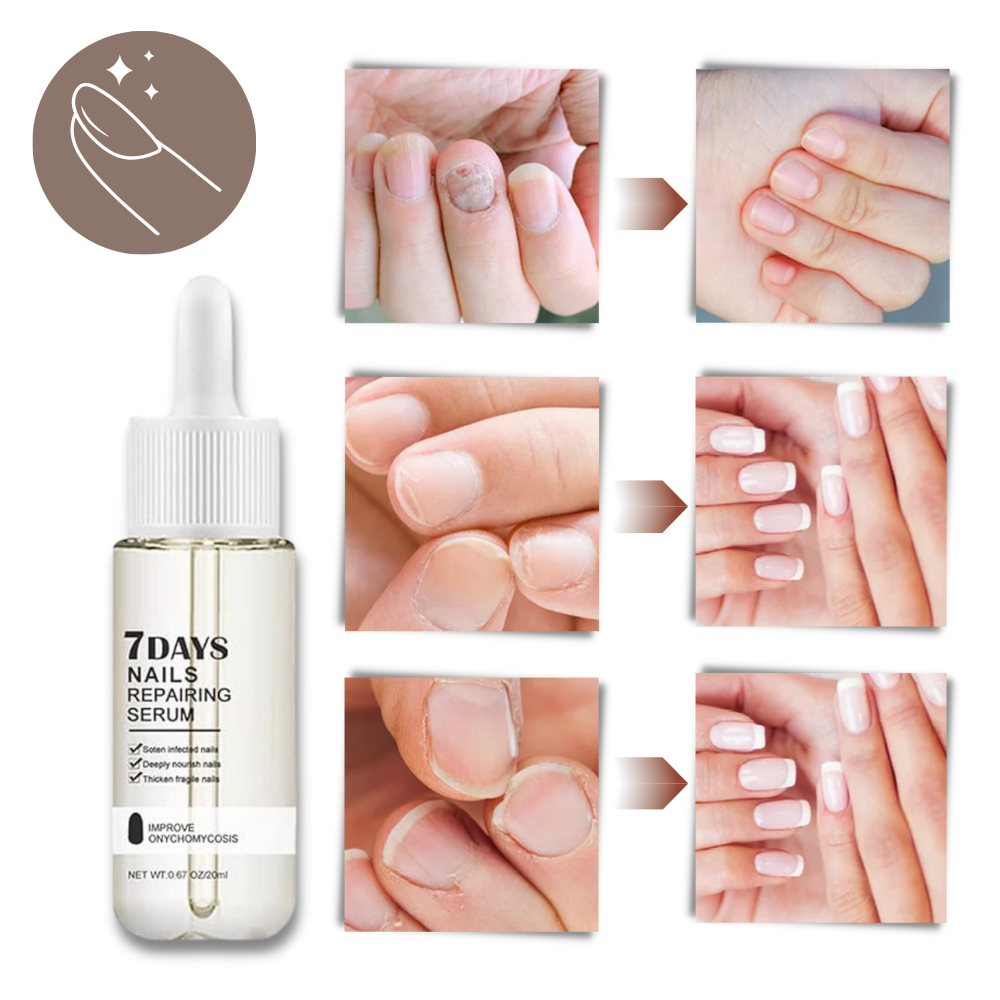 Sérum reparador para unhas Yohome, aplicado nas unhas, promovendo fortalecimento e reparação em 7 dias.