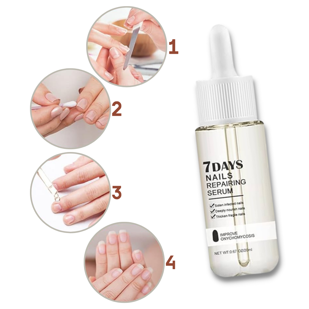 Sérum reparador para unhas Yohome, frasco com conta-gotas, aplicado nas unhas, promovendo reparação em 7 dias.