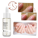 Sérum reparador para unhas Yohome, frasco com aplicador, mostrando a textura do produto para fortalecimento em 7 dias.