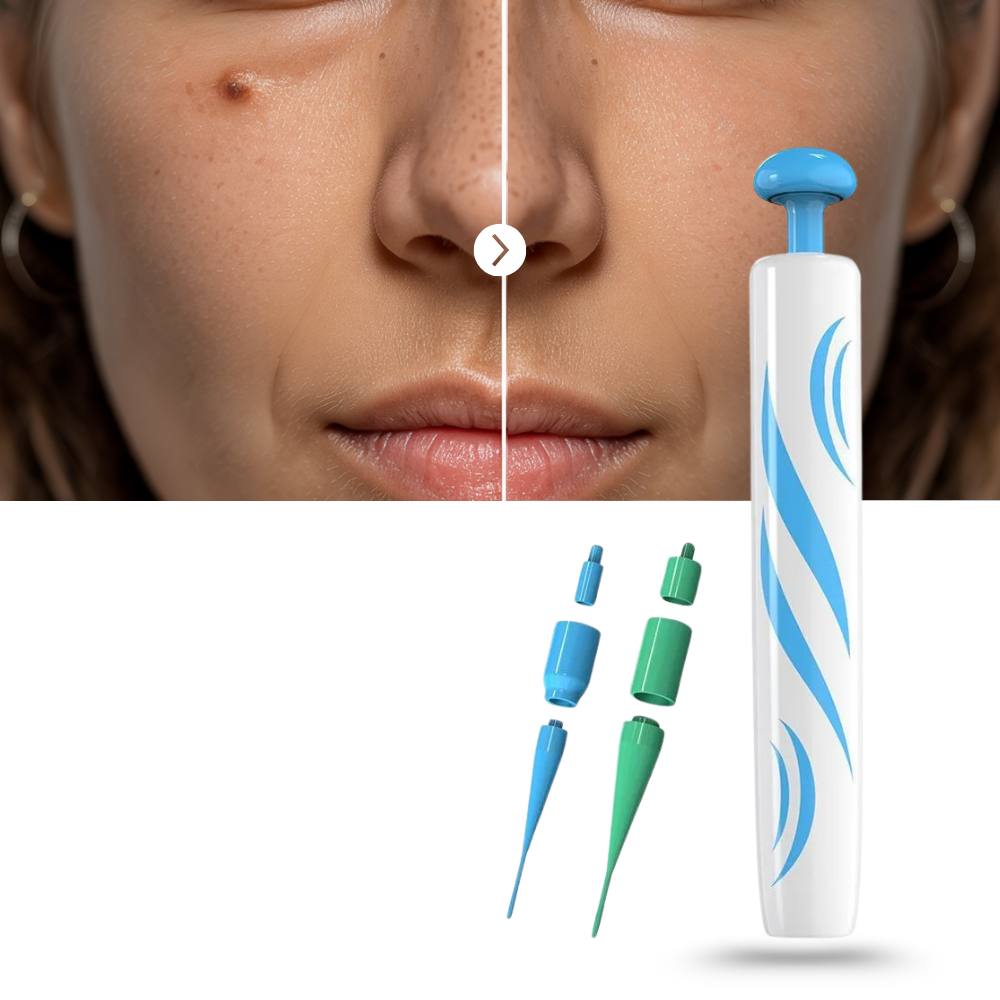 Kit de tratamento profissional para acrocordons da Zerone, com cosméticos específicos para remoção de verrugas cutâneas.