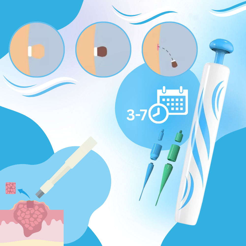 Kit de tratamento profissional Zerone para remoção de acrochordons, incluindo cosméticos de uso dermatológico.