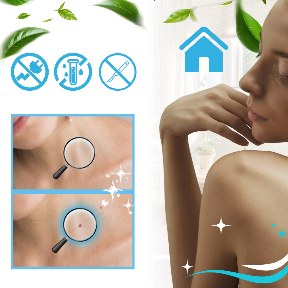 Kit de tratamento profissional Zerone para acrochordons, incluindo cosméticos para remoção de pequenas lesões cutâneas.